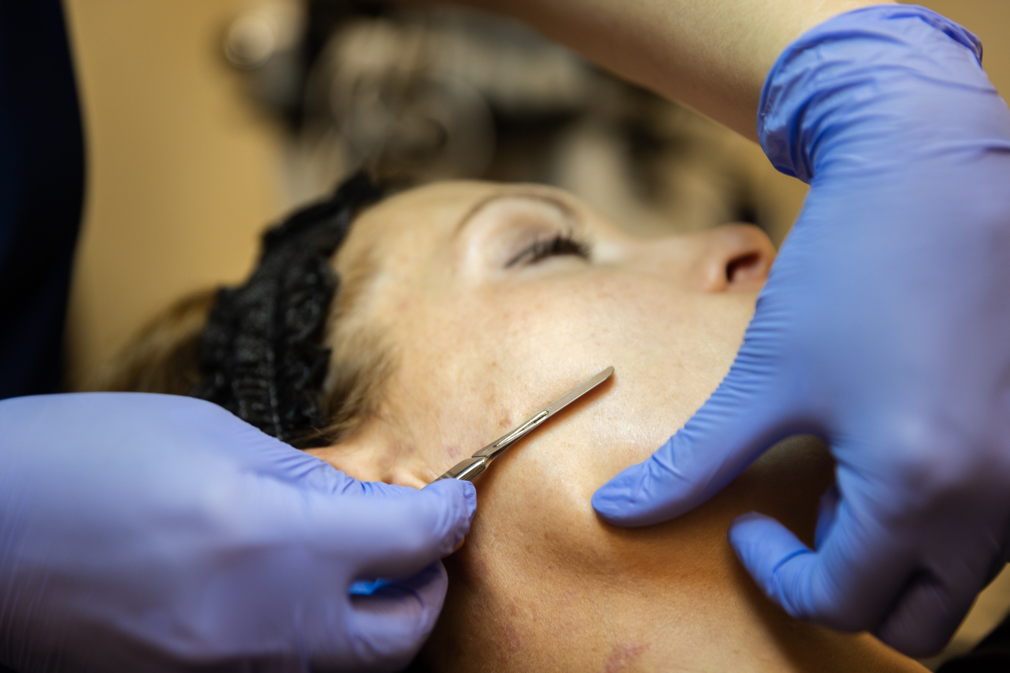 A close up of a specialized planar being used on a patient's face.