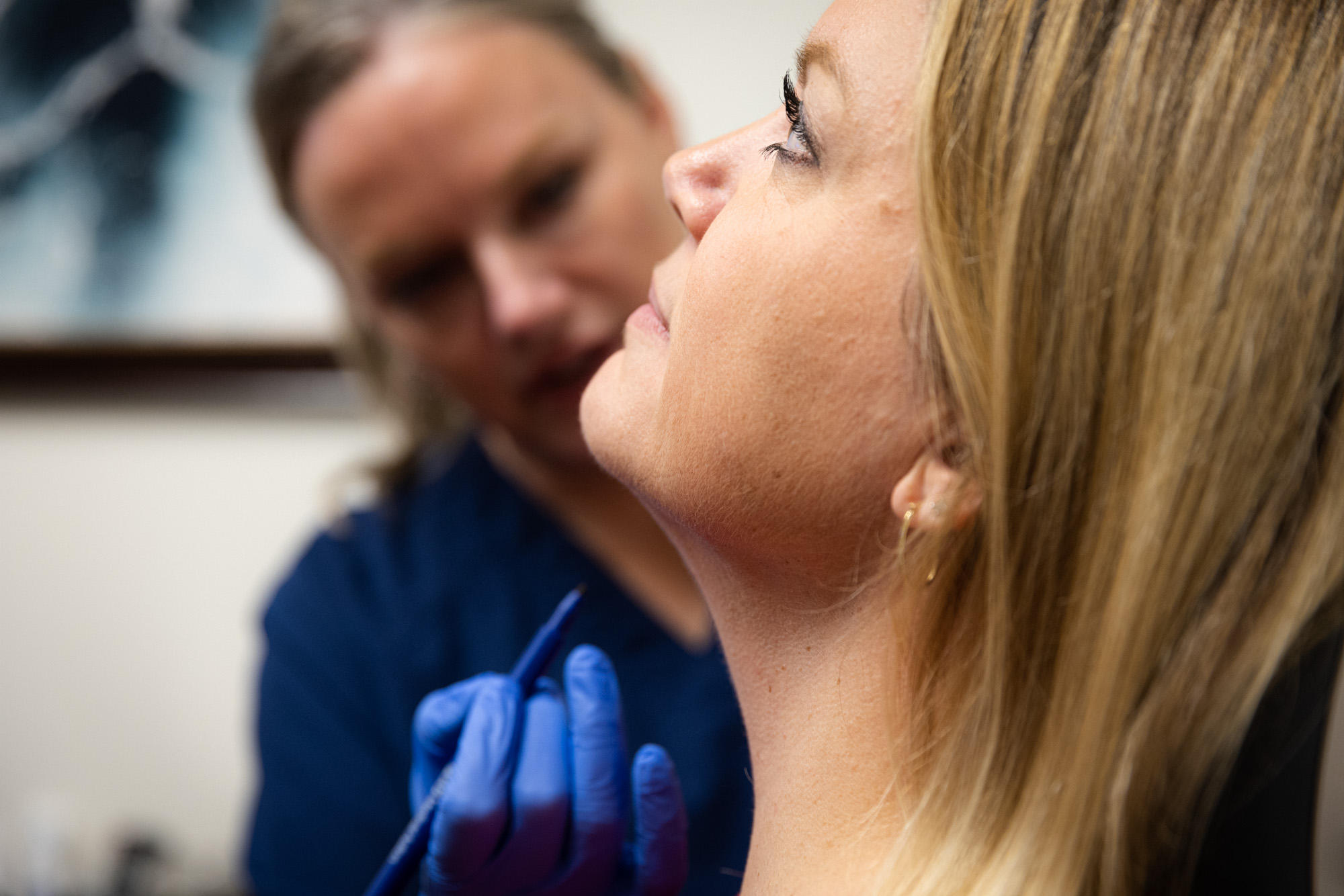 A patient looks up as an Envision specialist plans her Kybella injection.