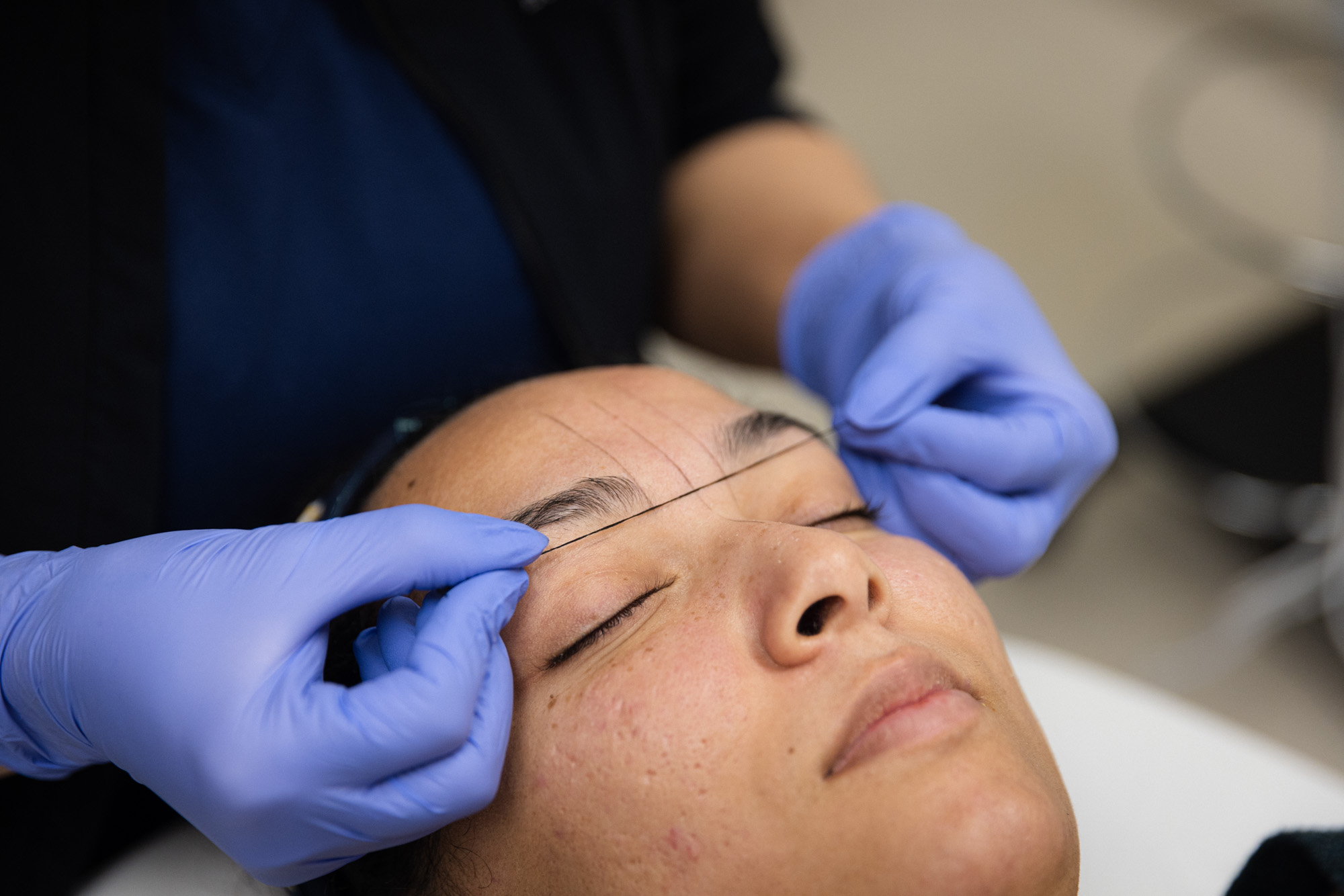 Microblading being used on a relaxed patient's face. Microblading is a non-invasive, non surgical procedure for fuller eyebrows.
