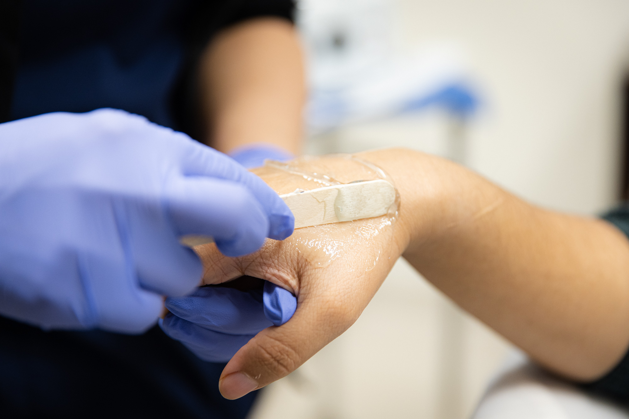 A specialist applies waxing to a patient's hand. While we use state of the art technology, there's no replacement for what has been proven to work.