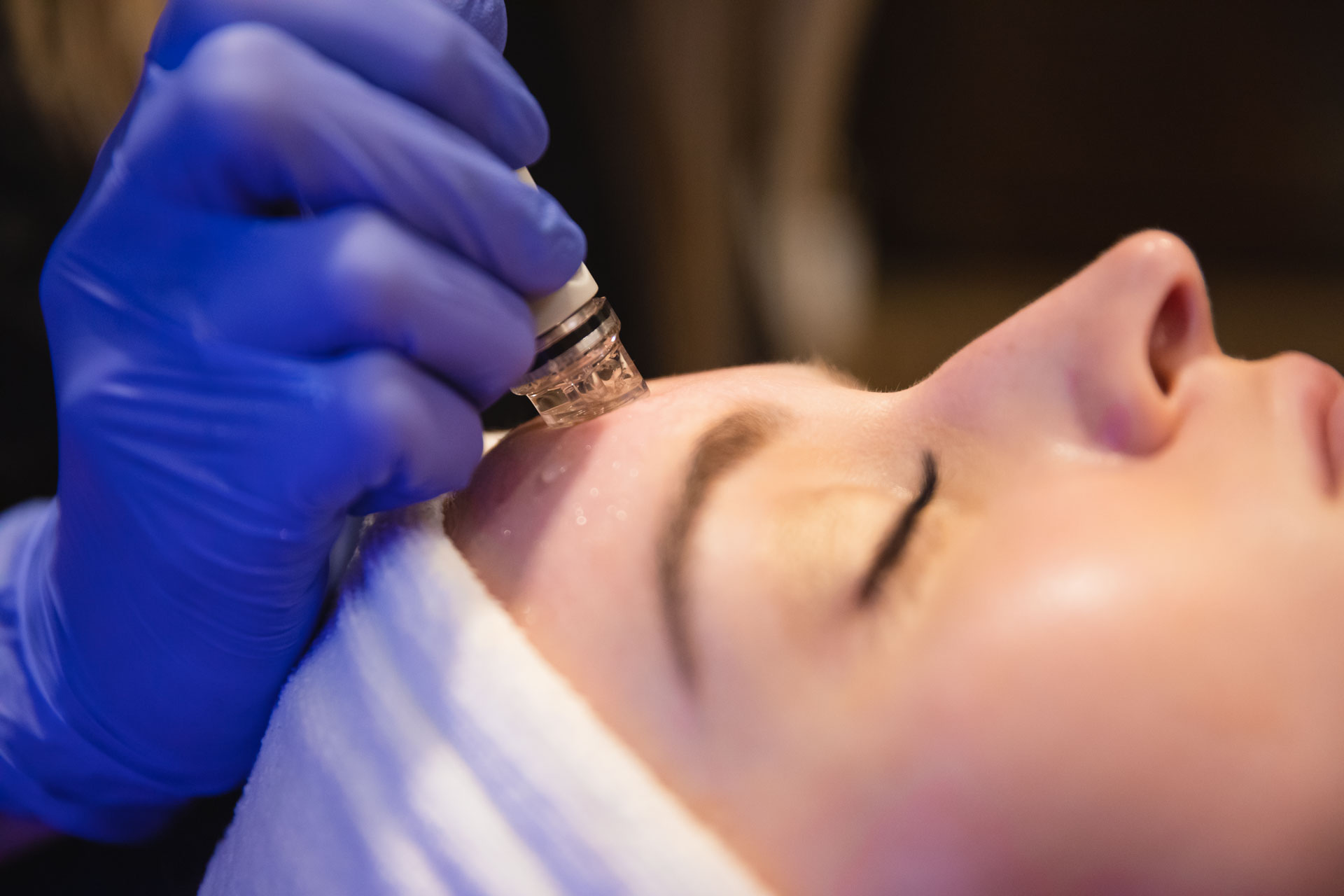 Patient receiving a HydraFacial in Rochester at Envision Aesthetics