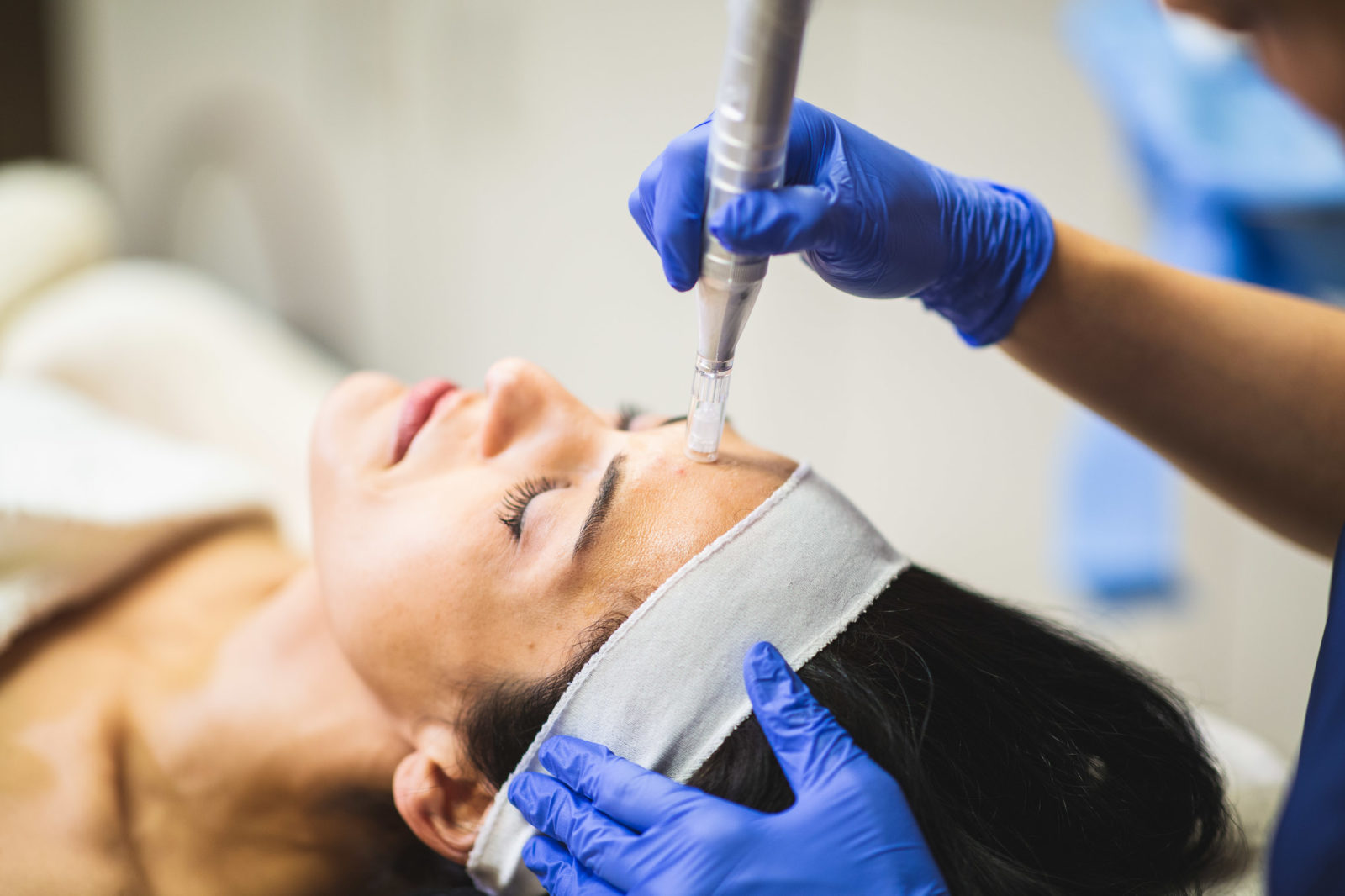 envision aesthetics medical provider administering microneedling in rochester to a female patient