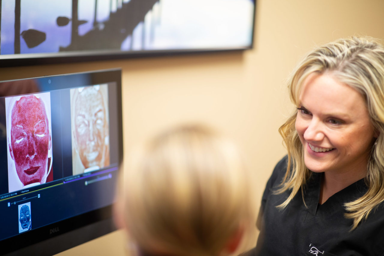 skin consultation at envision aesthetics in rochester to determine whether or not a patient should receive a halo treatment
