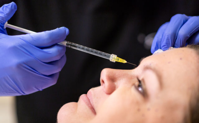 botox, fillers, and more in rochester - patient